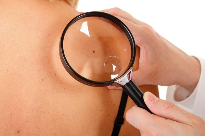 Patient examination with HPV